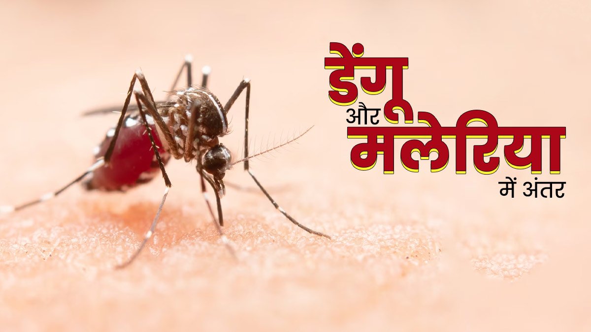 डेंगू मलेरिया का फर्क